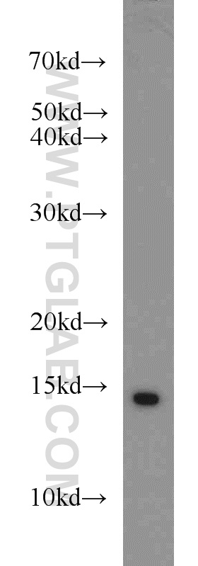 SNRPD3 Polyclonal antibody