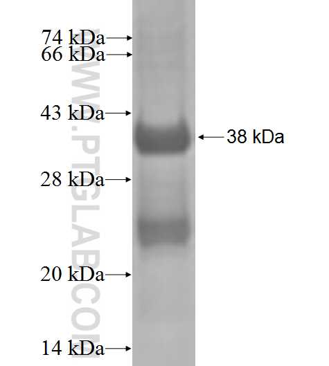 SNRPD3 fusion protein Ag0293 SDS-PAGE