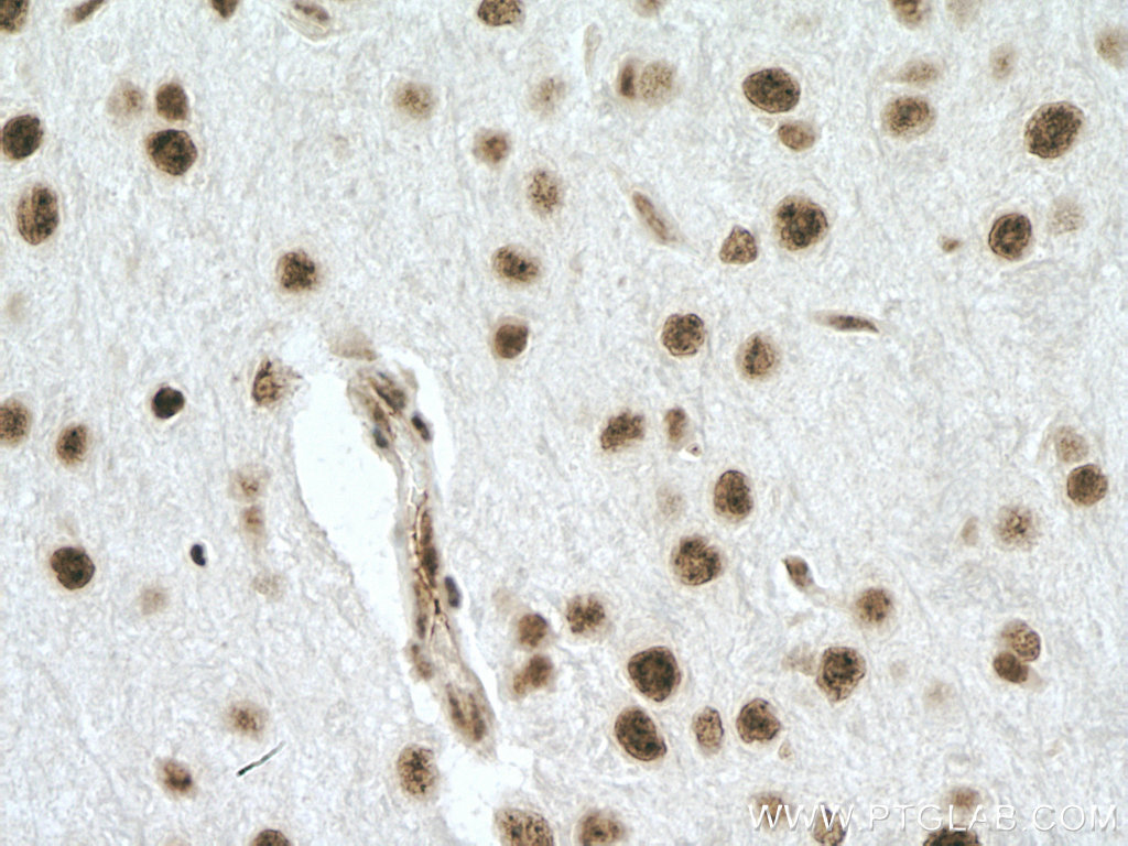 IHC staining of mouse brain using 20407-1-AP