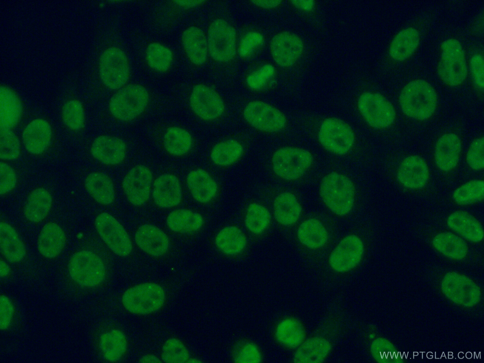 IF Staining of HeLa using 14977-1-AP