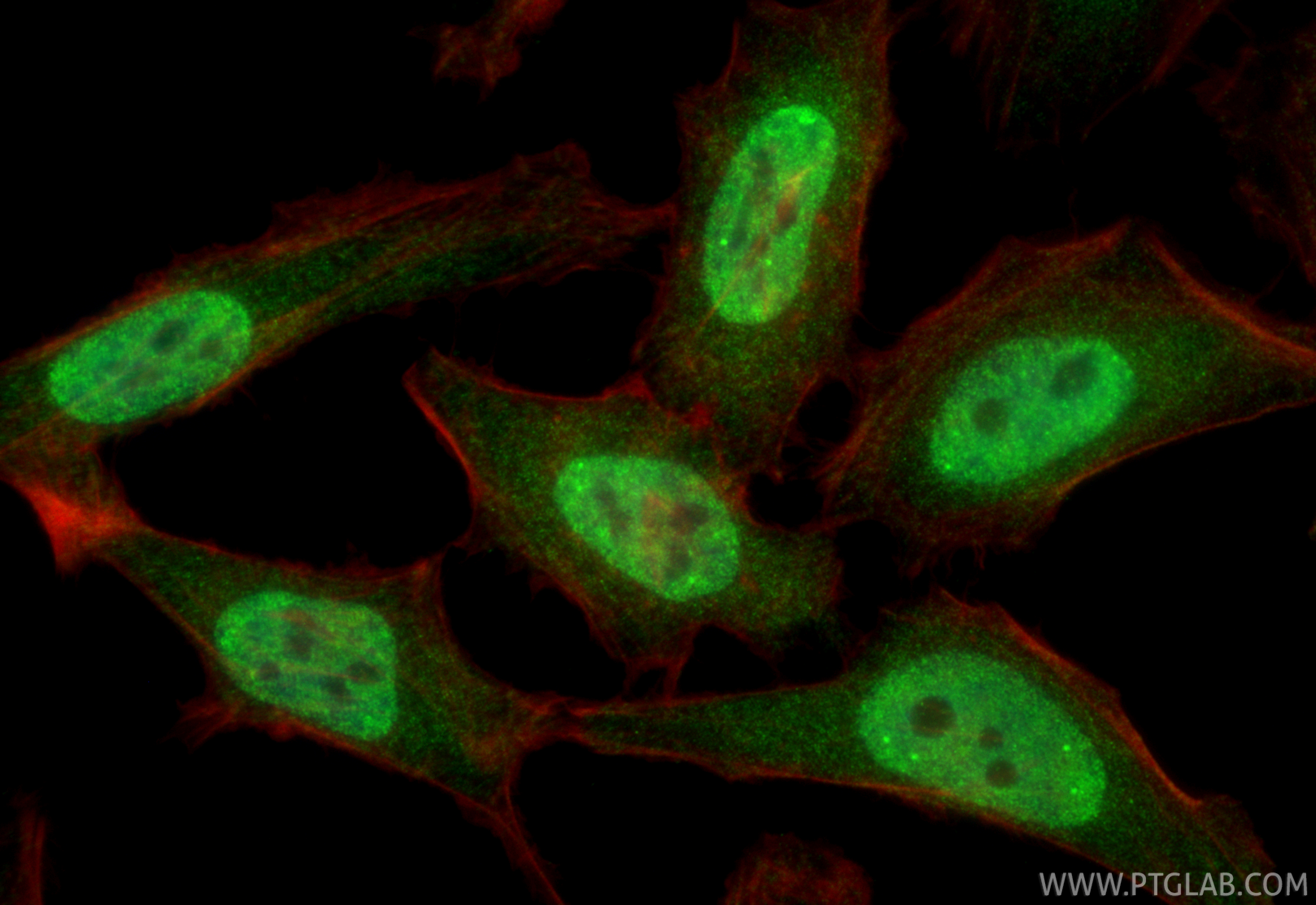 IF Staining of HeLa using 14977-1-AP IF Staining of HeLa using 14977-1-AP