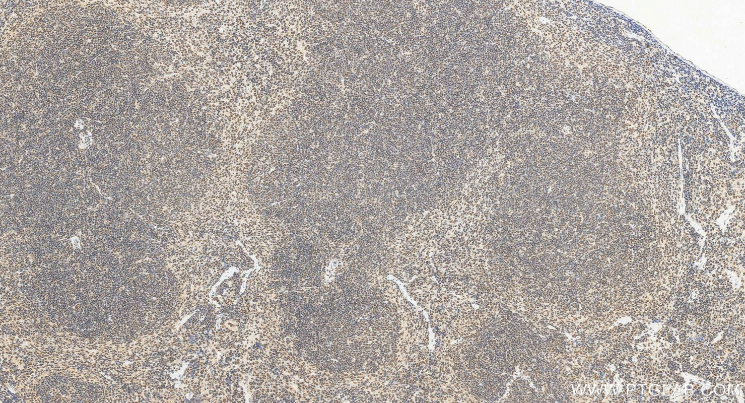 IHC staining of mouse spleen using 14977-1-AP IHC staining of mouse spleen using 14977-1-AP
