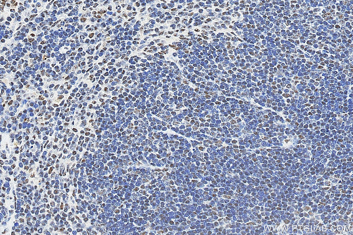 IHC staining of mouse spleen using 14977-1-AP IHC staining of mouse spleen using 14977-1-AP