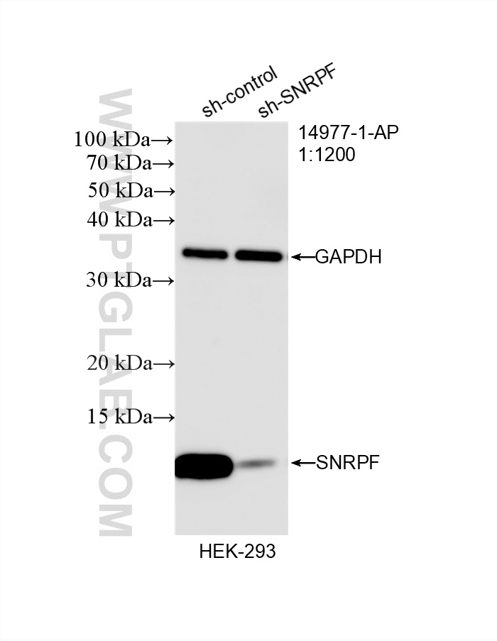 WB analysis of HEK-293 using 14977-1-AP WB analysis of HEK-293 using 14977-1-AP