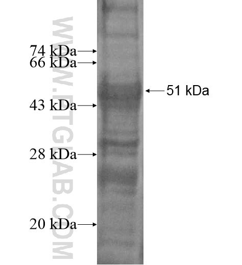 SNRPN fusion protein Ag14217 SDS-PAGE SNRPN fusion protein Ag14217 SDS-PAGE