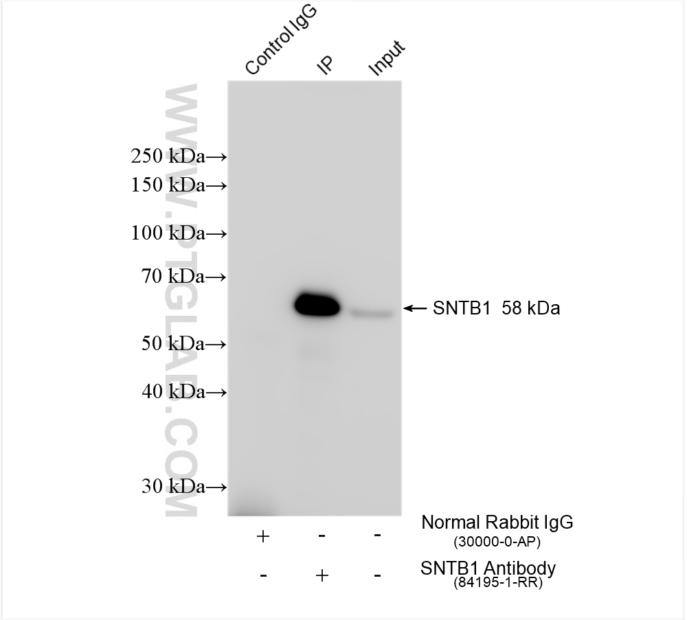 IP experiment of HepG2 using 84195-1-RR