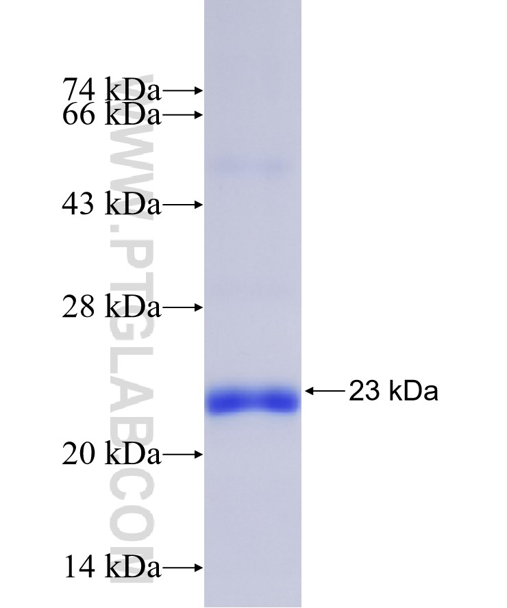 SNTN fusion protein Ag36130 SDS-PAGE SNTN fusion protein Ag36130 SDS-PAGE