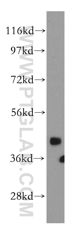 SNUPN Polyclonal antibody