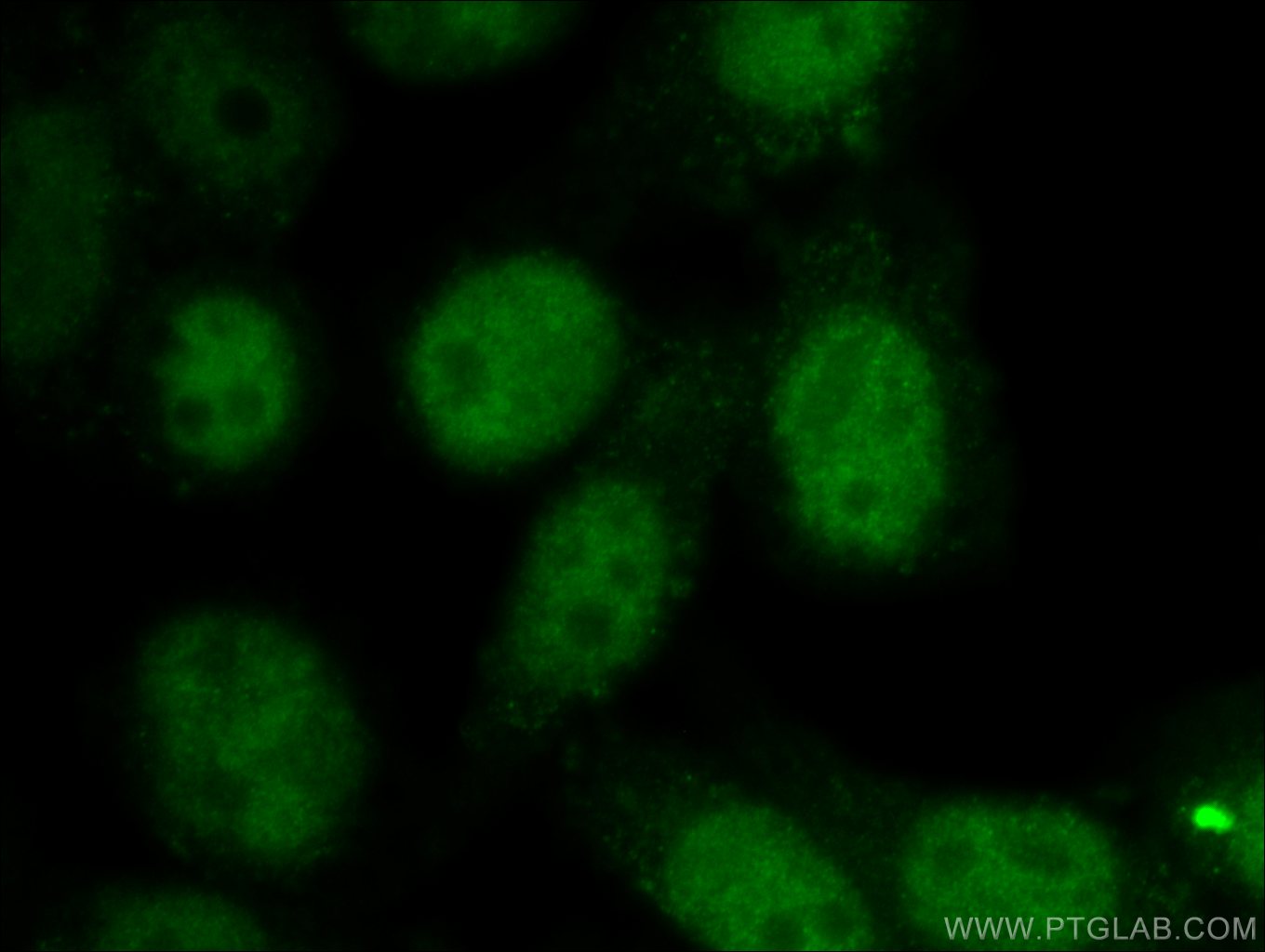 IF Staining of HepG2 using 25926-1-AP