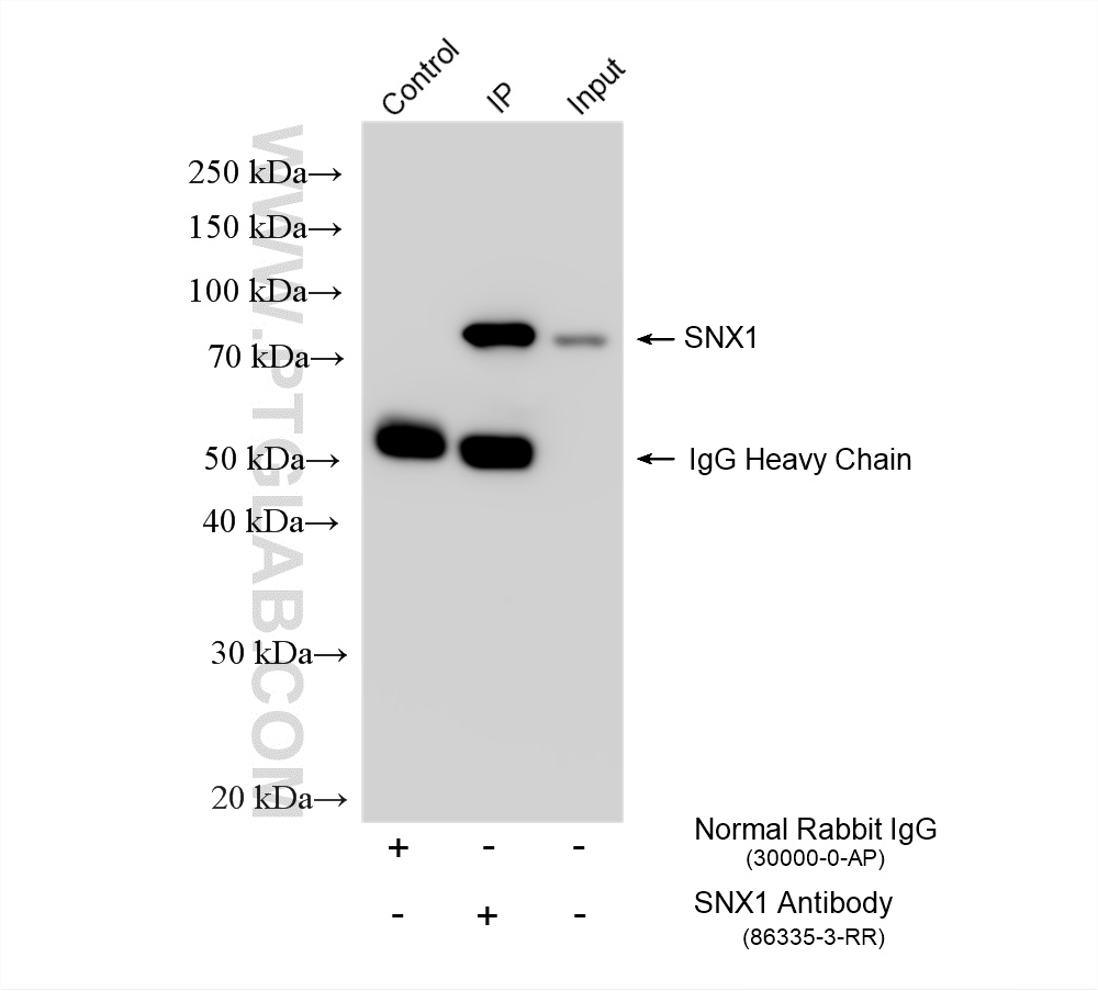 IP experiment of HeLa using 86335-3-RR