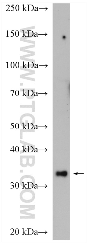 WB analysis of HeLa using 14953-1-AP