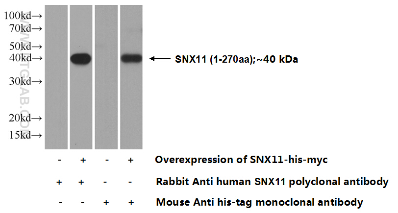 SNX11