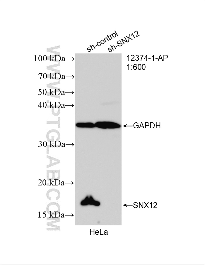 WB result of SNX12 antibody (12374-1-AP; 1:600; incubated at room temperature for 1.5 hours) with sh-Control and sh-SNX12 transfected HeLa cells. WB analysis of HeLa using 12374-1-AP