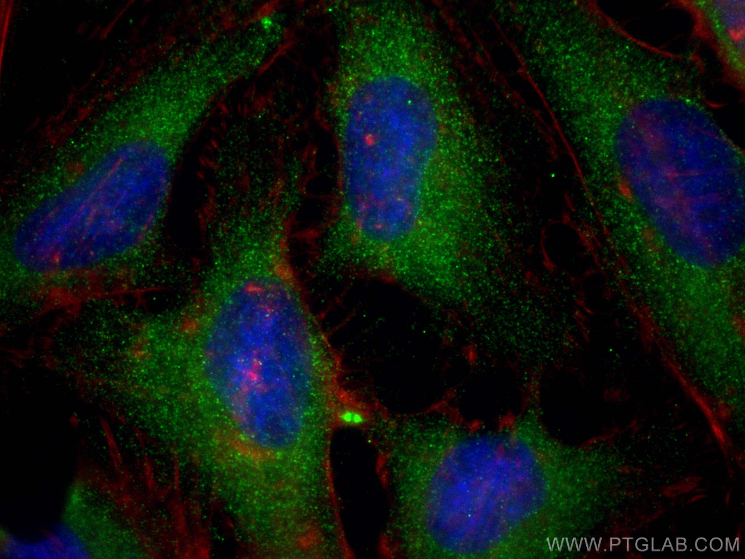 IF Staining of HeLa using 68260-1-Ig (same clone as 68260-1-PBS)