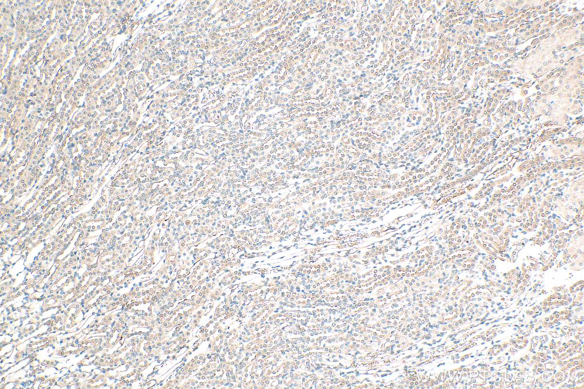 IHC staining of mouse kidney using 16049-1-AP