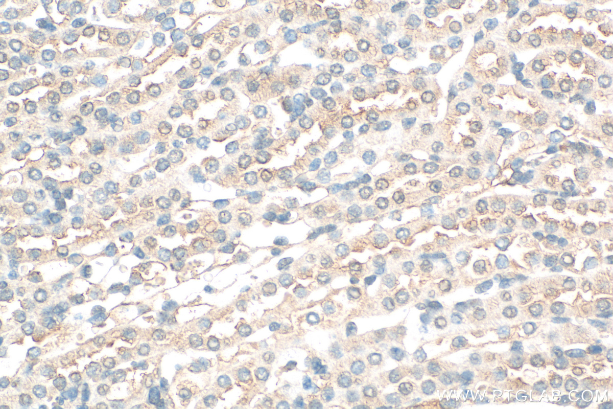 IHC staining of mouse kidney using 16049-1-AP