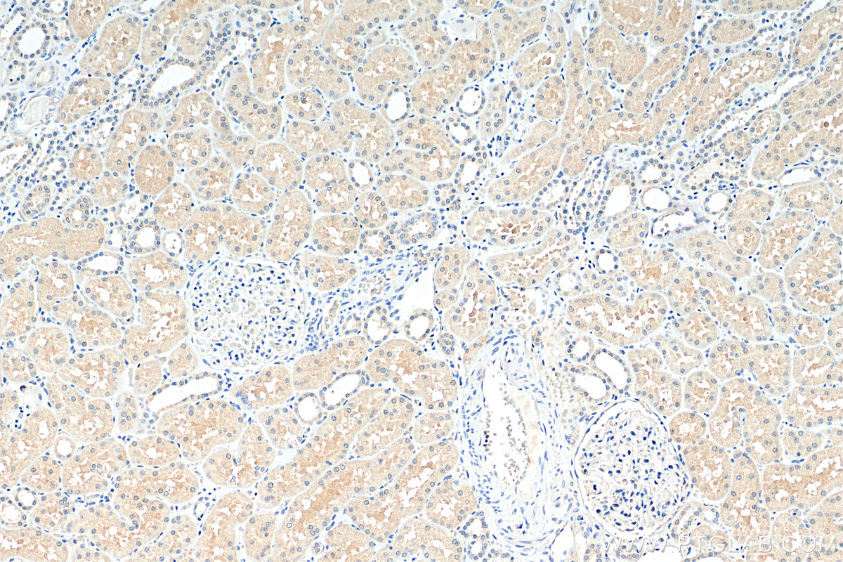 IHC staining of human kidney using 68239-1-Ig