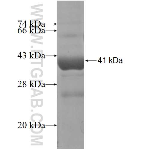 SNX16 fusion protein Ag4607 SDS-PAGE SNX16 fusion protein Ag4607 SDS-PAGE
