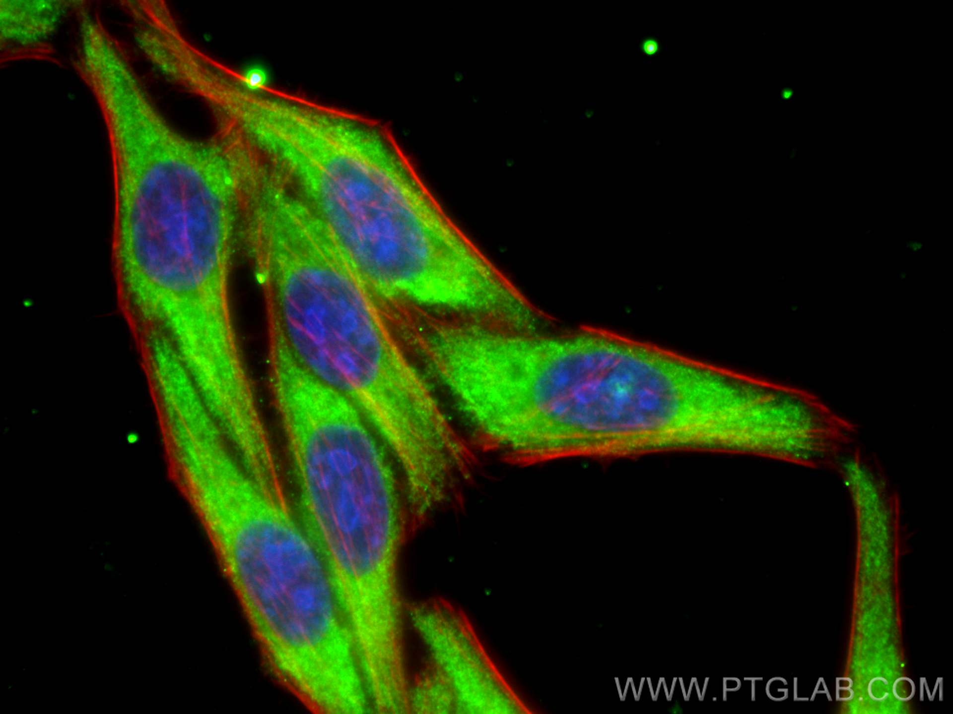 IF Staining of HepG2 using 68256-1-Ig (same clone as 68256-1-PBS)