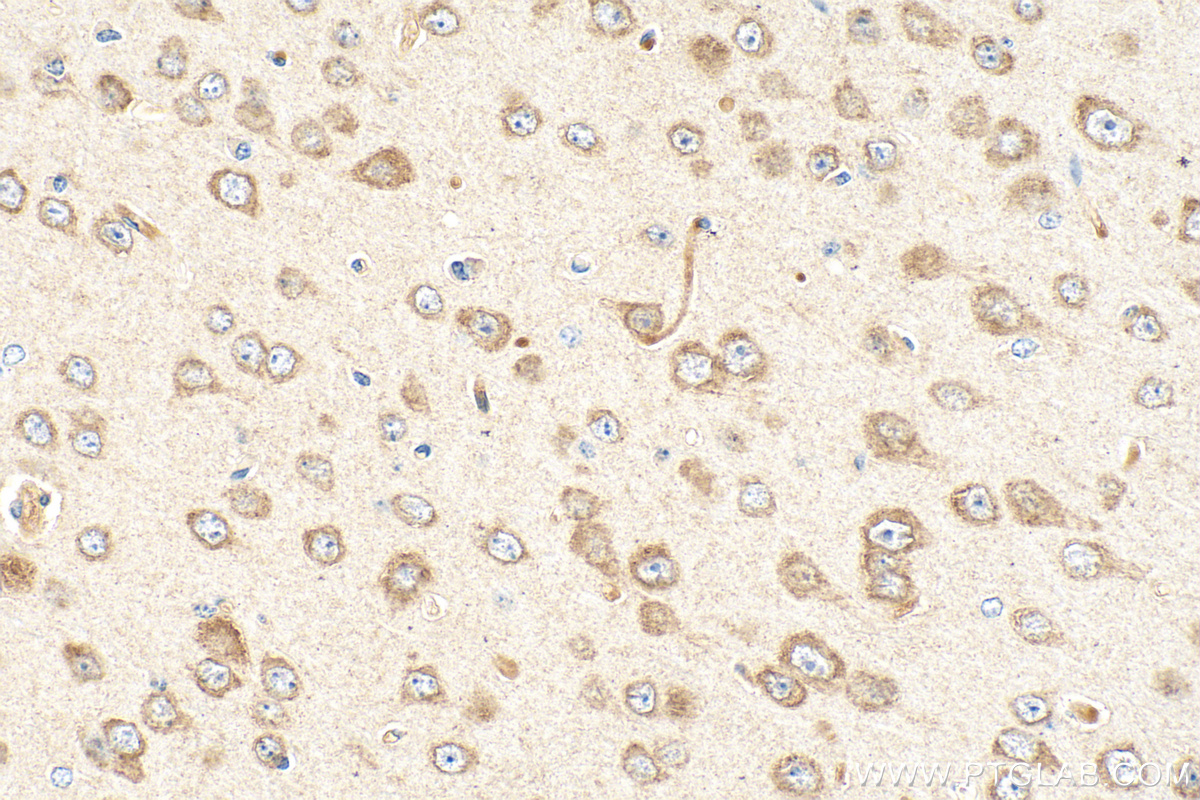 Immunohistochemical analysis of paraffin-embedded mouse brain tissue slide using 68256-1-Ig (SNX17 antibody) at dilution of 1:2000 (under 40x lens). Heat mediated antigen retrieval with Tris-EDTA buffer (pH 9.0). IHC staining of mouse brain using 68256-1-Ig