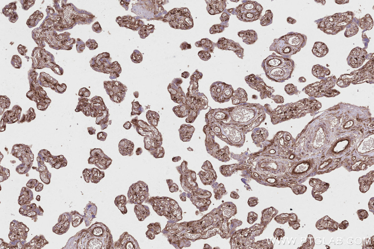 IHC staining of human placenta using 21946-1-AP