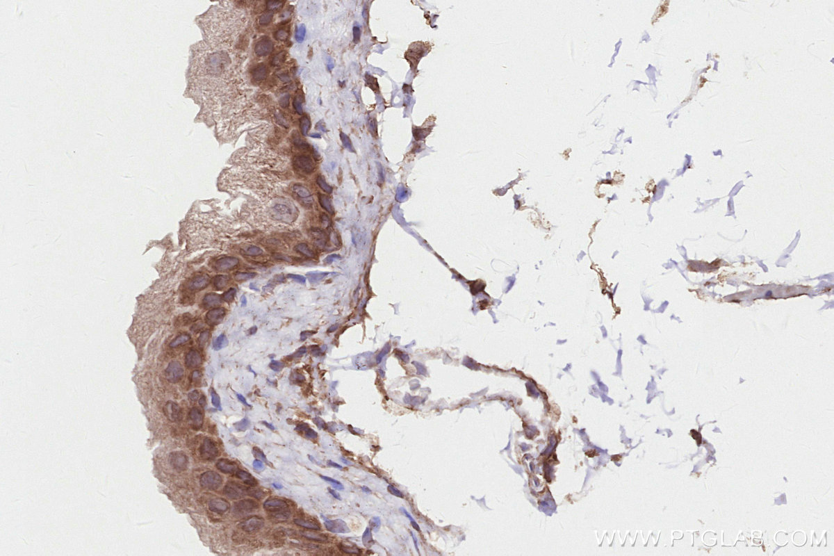 IHC staining of mouse bladder using 21946-1-AP