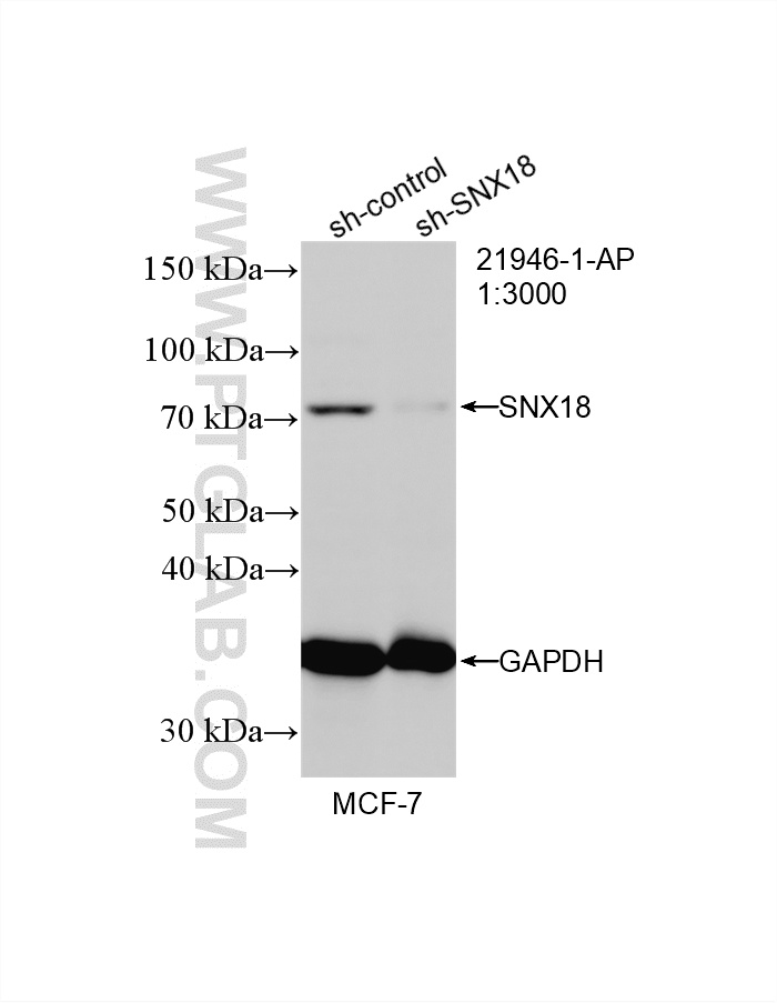 WB result of SNX18 antibody (21946-1-AP; 1:3000; incubated at room temperature for 1.5 hours) with sh-Control and sh-SNX18 transfected MCF-7 cells. WB analysis of MCF-7 using 21946-1-AP