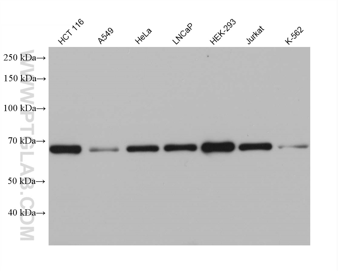 WB analysis using 68305-1-Ig (same clone as 68305-1-PBS)