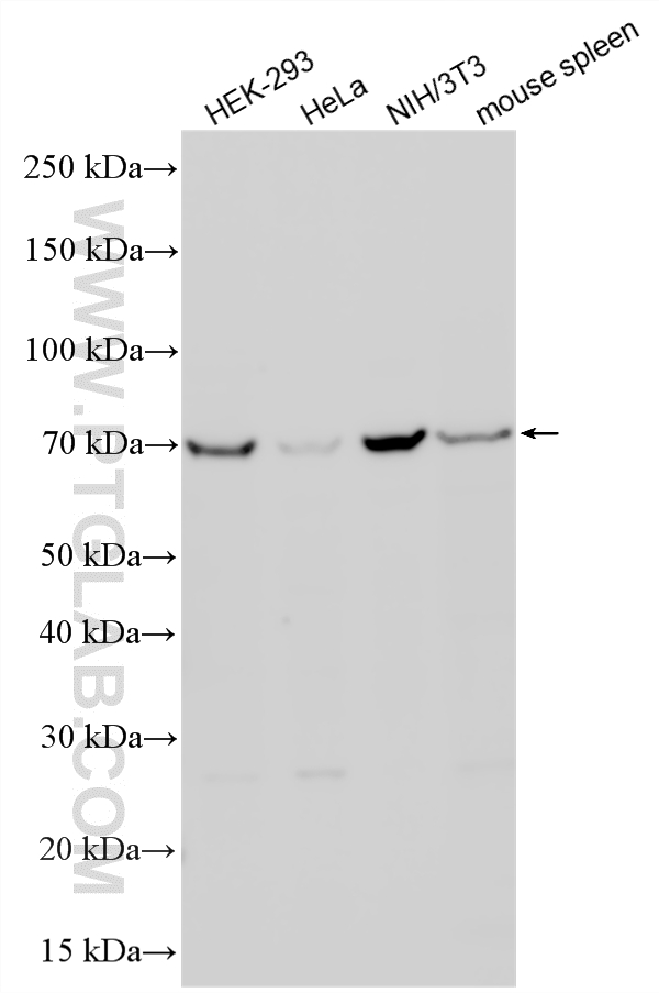 WB analysis using 11737-1-AP