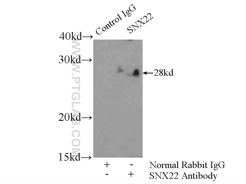 IP experiment of mouse liver using 13062-1-AP