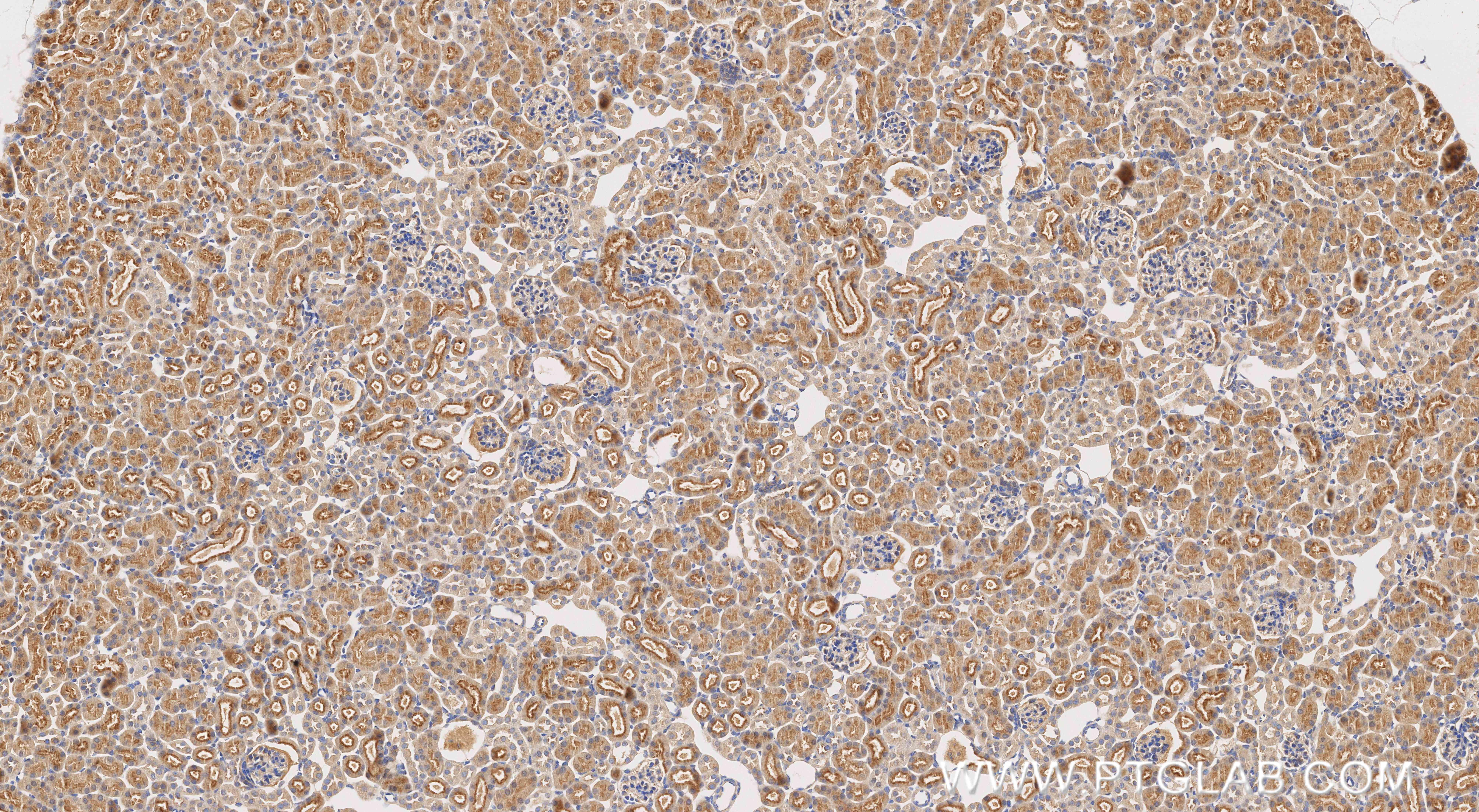IHC staining of mouse kidney using 87039-1-RR IHC staining of mouse kidney using 87039-1-RR