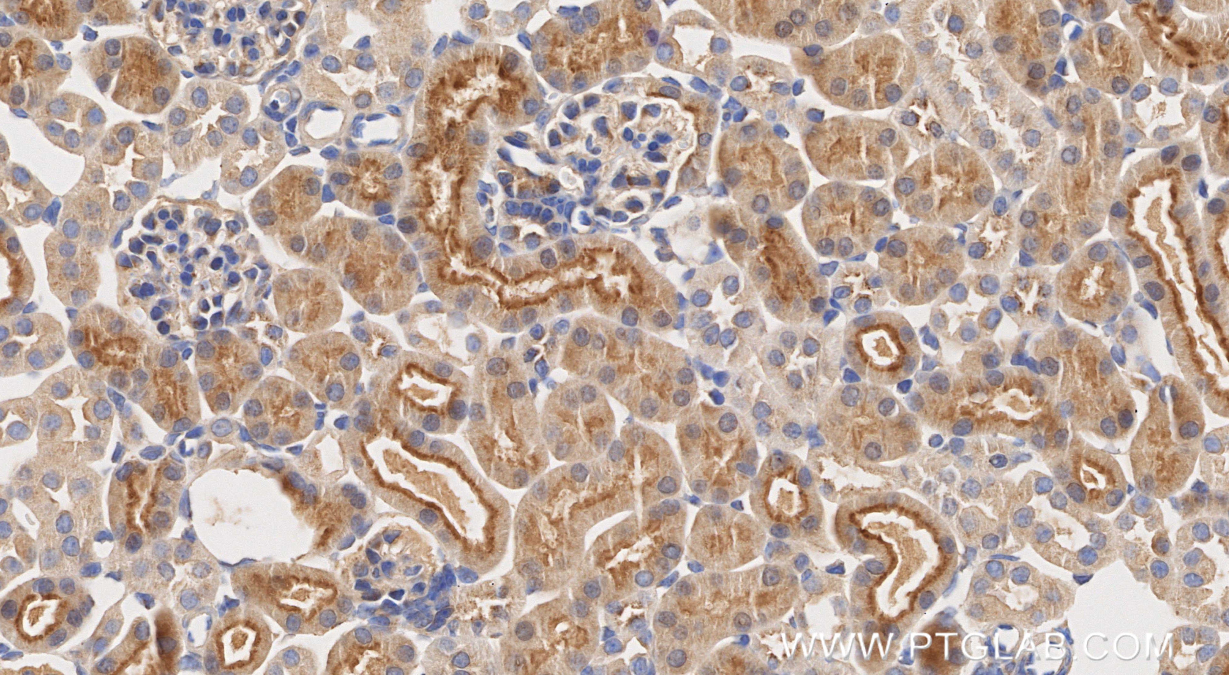 IHC staining of mouse kidney using 87039-1-RR IHC staining of mouse kidney using 87039-1-RR