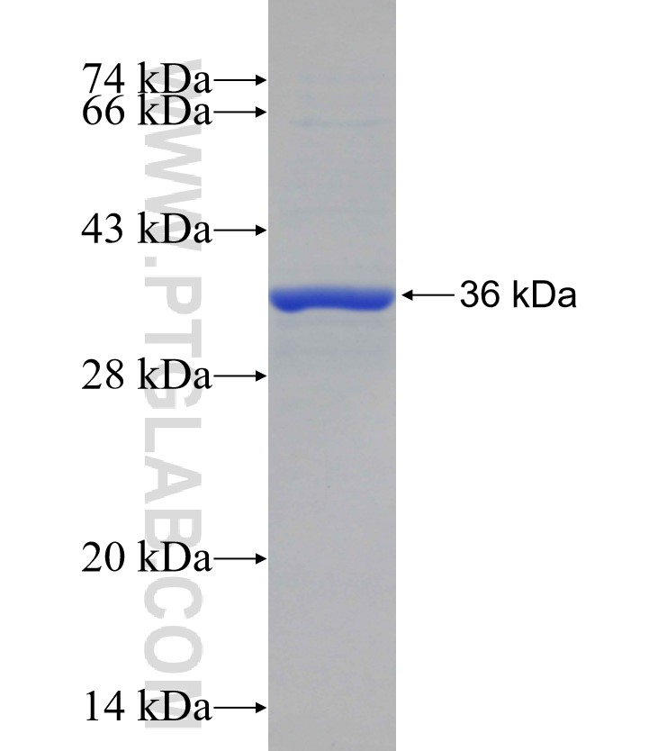 SNX27 fusion protein Ag29226 SDS-PAGE SNX27 fusion protein Ag29226 SDS-PAGE