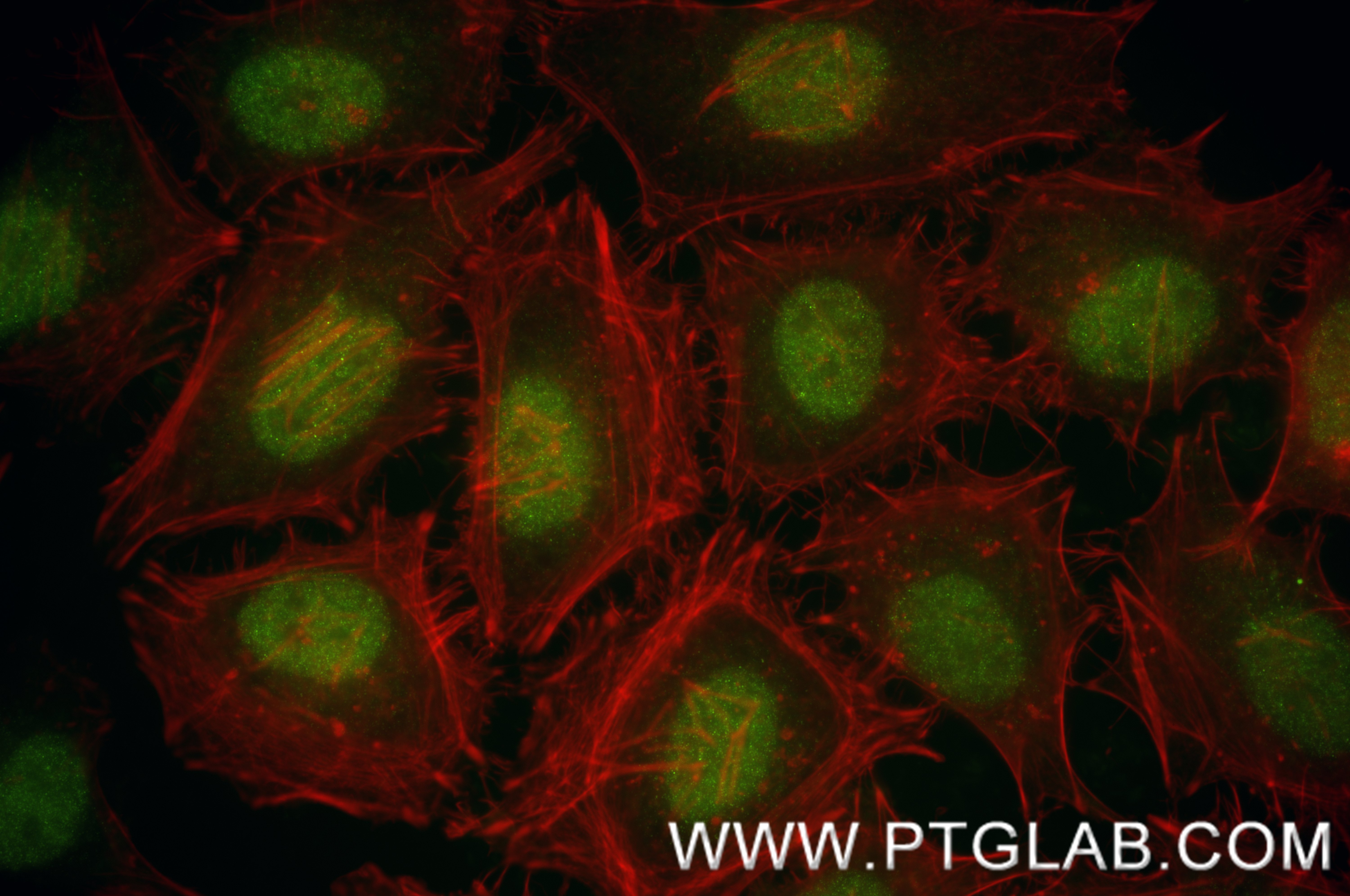 IF Staining of HeLa using 86446-1-RR (same clone as 86446-1-PBS)