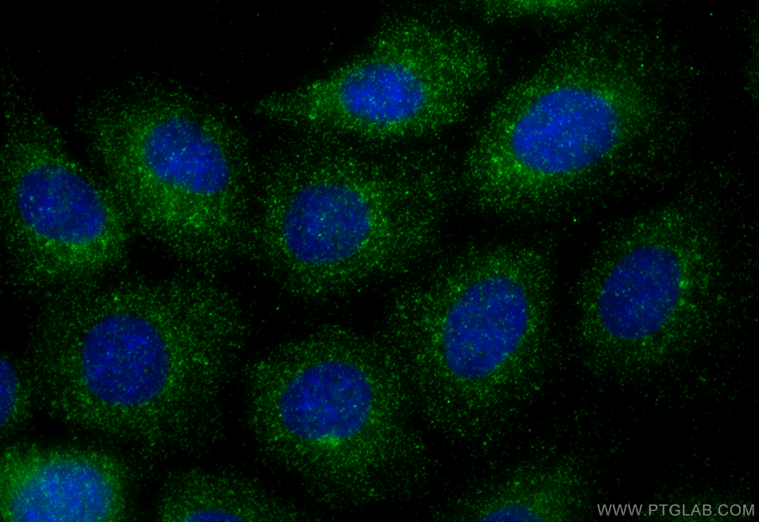 Immunofluorescent analysis of (-20°C Methanol) fixed A431 cells using SNX3 antibody (10772-1-AP) at dilution of 1:400 and CoraLite®488-Conjugated Goat Anti-Rabbit IgG(H+L) (<a class='green' href='/productredirect?CatalogNo=SA00013-2' target='_blank'>SA00013-2</a>). IF Staining of A431 using 10772-1-AP