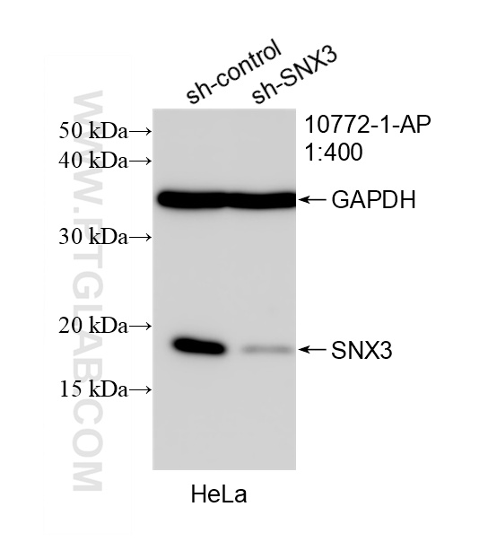 WB result of SNX3 antibody (10772-1-AP; 1:400; incubated at room temperature for 1.5 hours) with sh-Control and sh-SNX3 transfected HeLa cells. WB analysis of HeLa using 10772-1-AP
