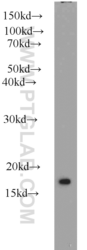 SNX3 Polyclonal antibody