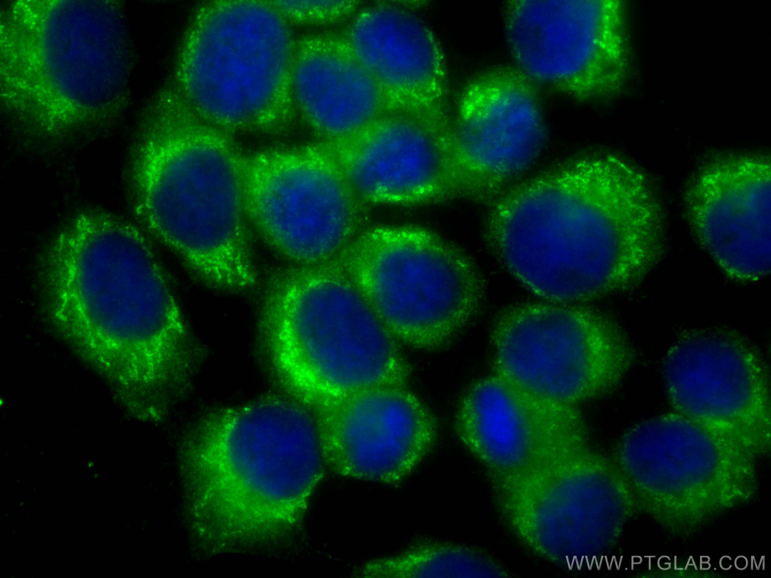 IF Staining of A431 using 68292-1-Ig
