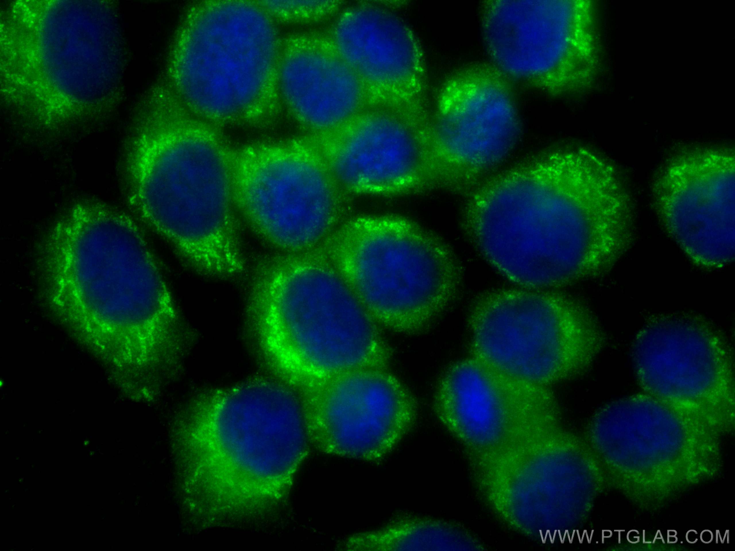 IF Staining of A431 using 68292-1-Ig