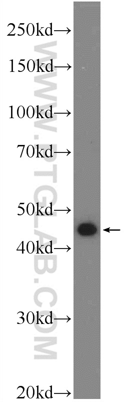 WB analysis of HeLa using 25763-1-AP