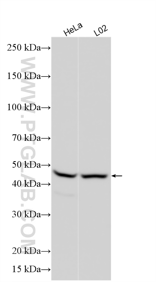 Various lysates were subjected to SDS PAGE followed by western blot with 25763-1-AP (SNX32 antibody) at dilution of 1:3000 incubated at room temperature for 1.5 hours. WB analysis using 25763-1-AP