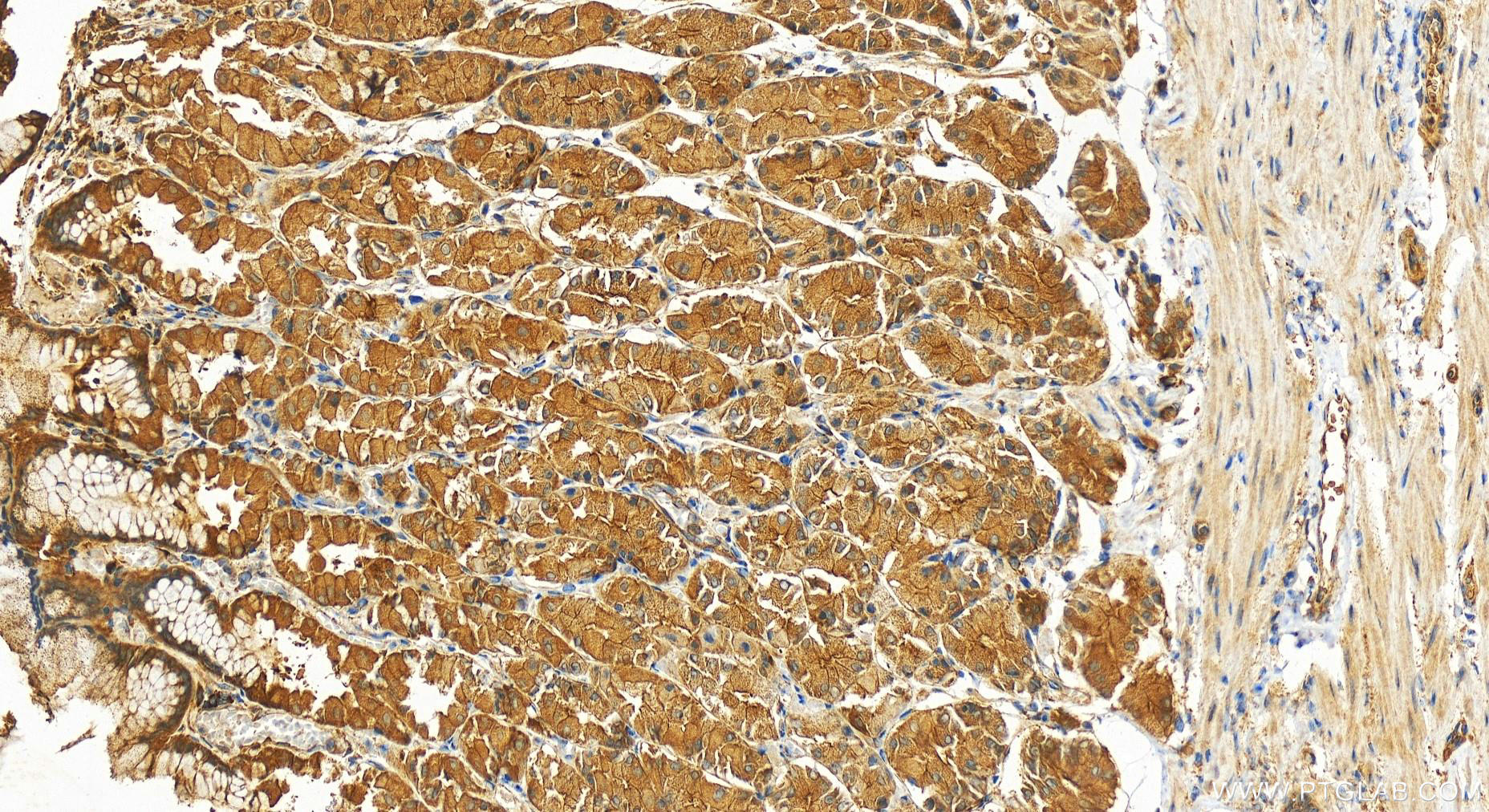 IHC staining of human stomach using 11506-1-AP