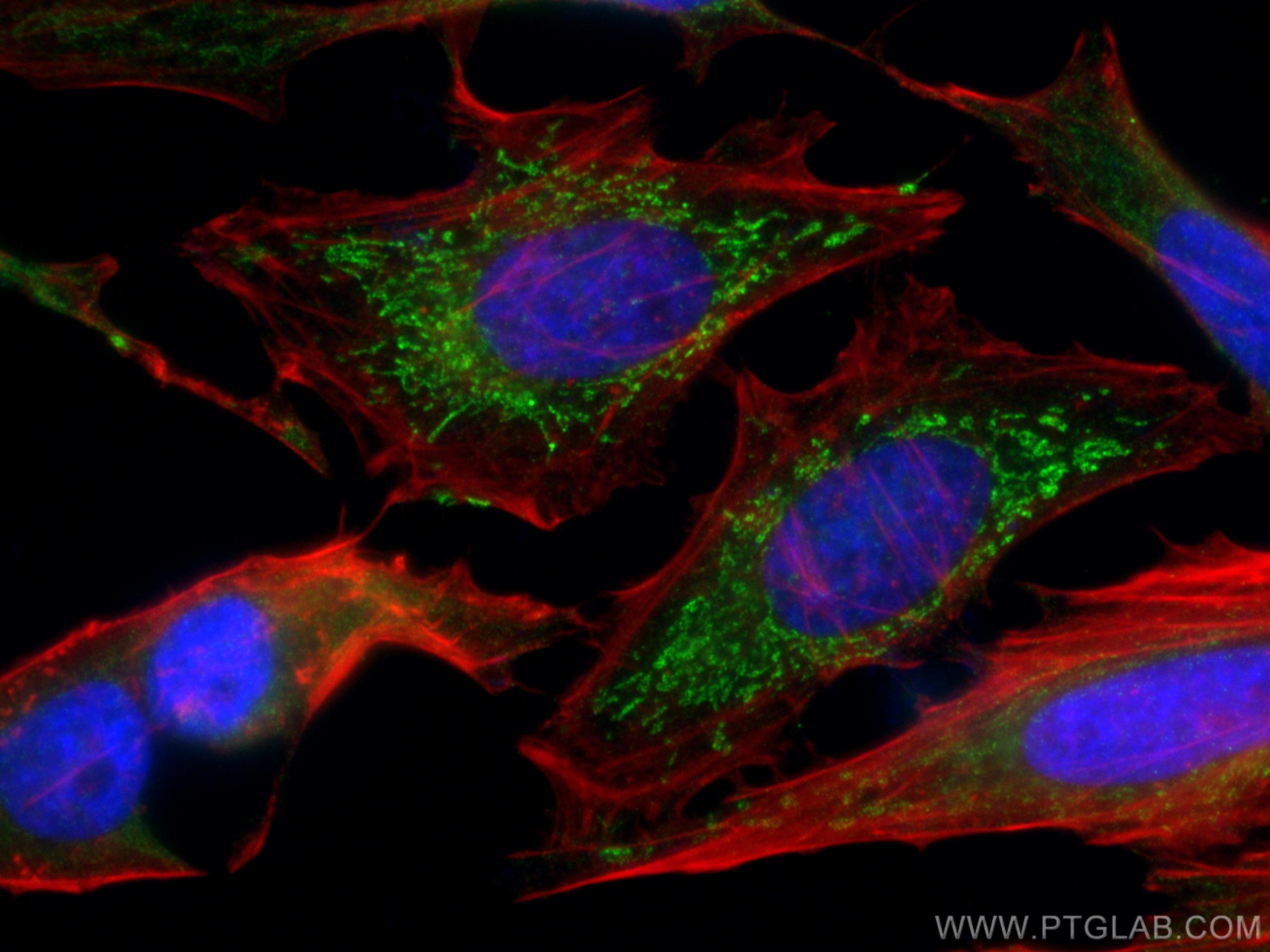 IF Staining of HeLa using 67665-1-Ig (same clone as 67665-1-PBS)