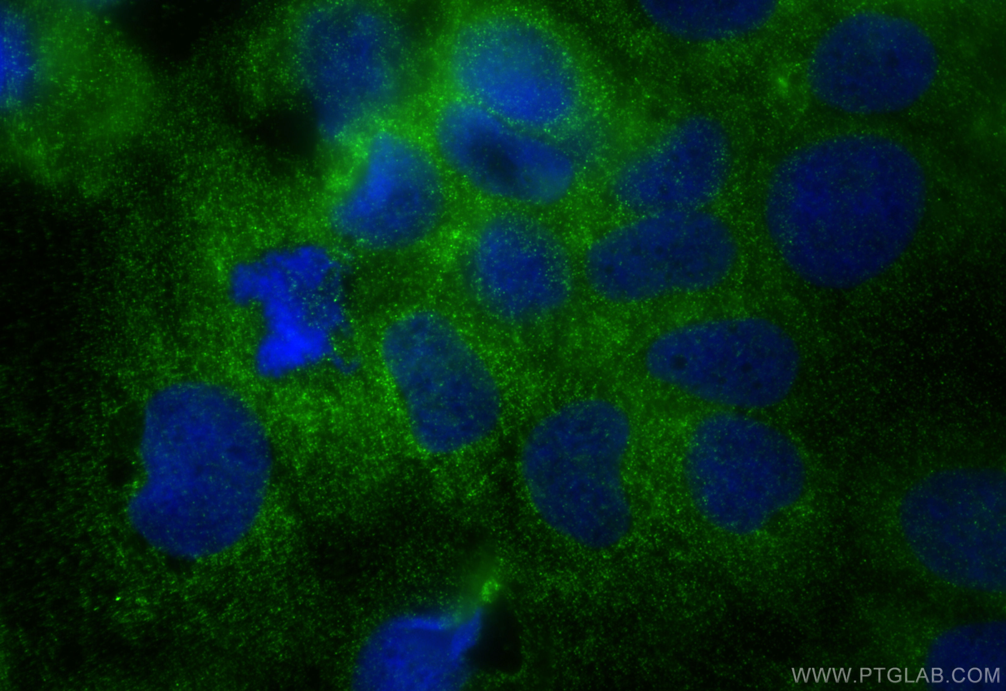IF Staining of Caco-2 using 67665-1-Ig