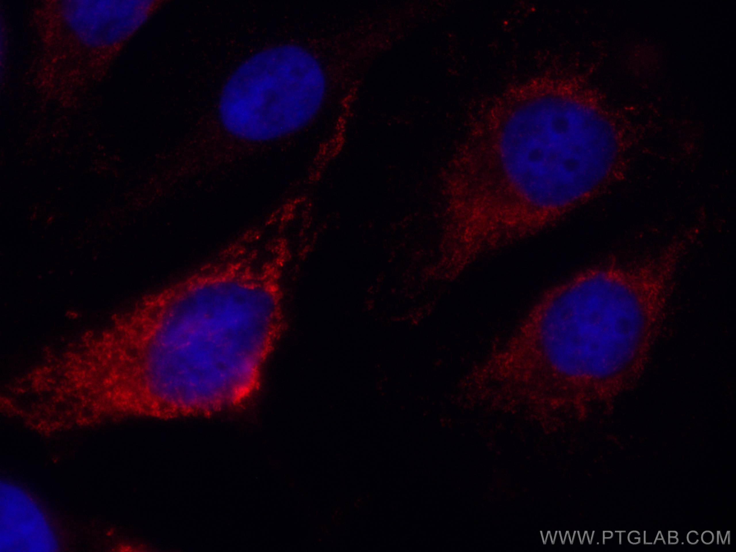 IF Staining of HeLa using CL594-67665