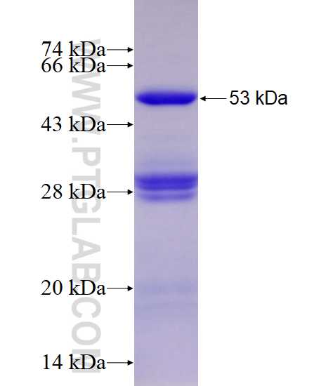 SNX5 fusion protein Ag12993 SDS-PAGE SNX5 fusion protein Ag12993 SDS-PAGE