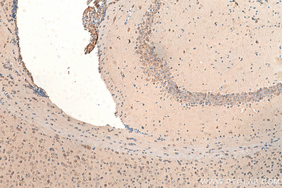 IHC staining of mouse brain using 10114-1-AP
