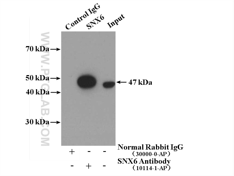 IP experiment of HepG2 using 10114-1-AP