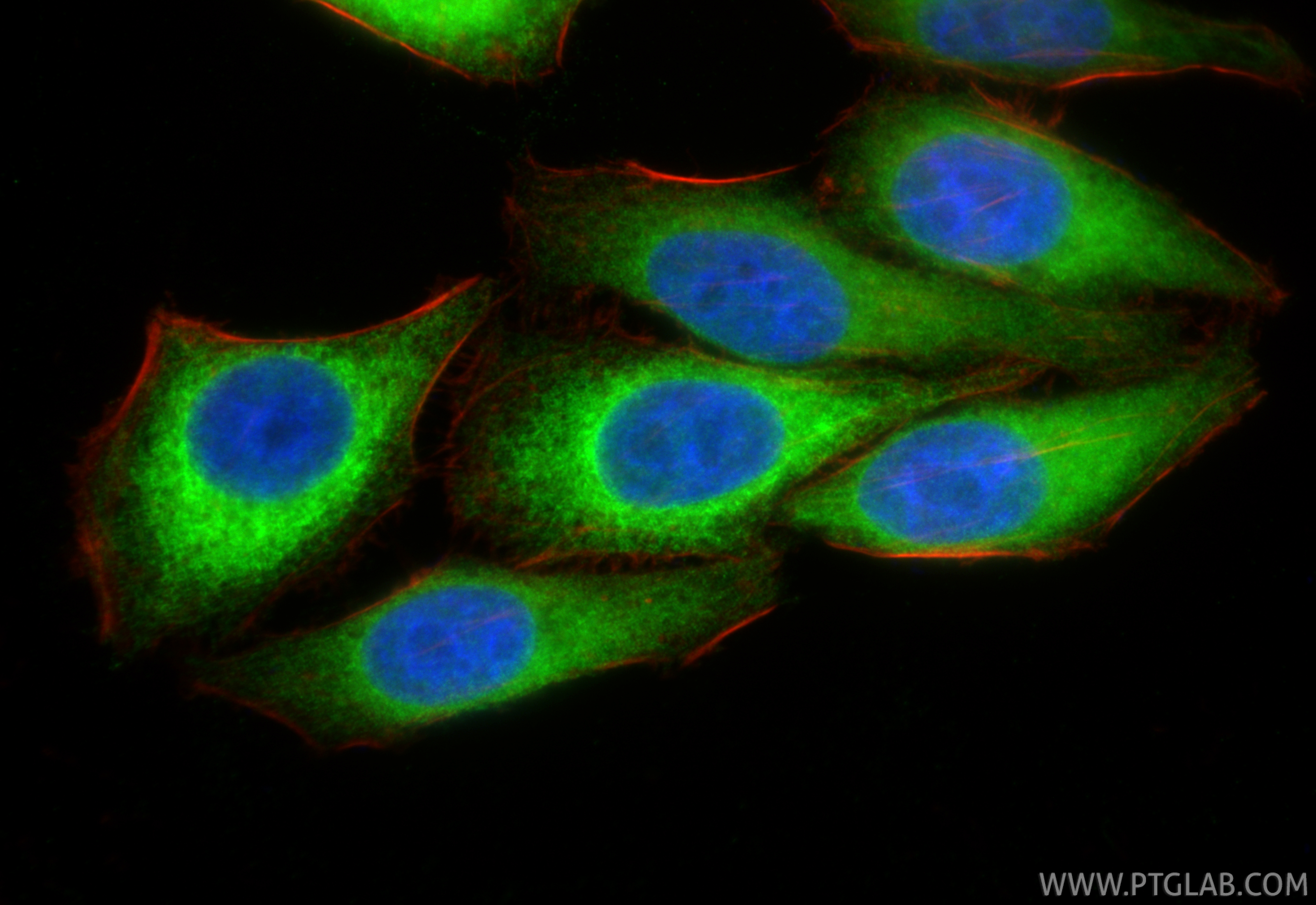 Immunofluorescent analysis of (4% PFA) fixed HepG2 cells using SOAT1/ACAT1 antibody (29369-1-AP) at dilution of 1:400 and CoraLite®488-Conjugated Goat Anti-Rabbit IgG(H+L) (<a class='green' href='/productredirect?CatalogNo=SA00013-2' target='_blank'>SA00013-2</a>), CL594-Phalloidin (red). IF Staining of HepG2 using 29369-1-AP
