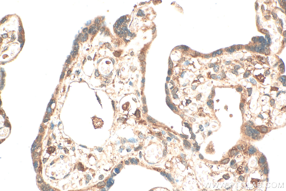 Immunohistochemical analysis of paraffin-embedded human placenta tissue slide using 29369-1-AP (SOAT1 antibody) at dilution of 1:200 (under 40x lens). Heat mediated antigen retrieval with Tris-EDTA buffer (pH 9.0). IHC staining of human placenta using 29369-1-AP